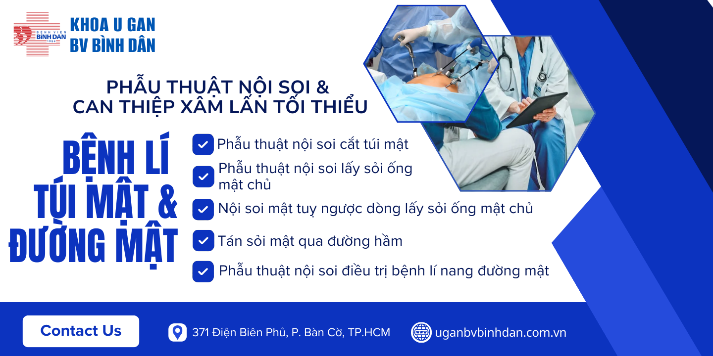 Sỏi mật Bình Dân